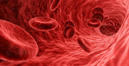 Risco de tromboembolismo venoso aumenta nos 30 dias após uma crise de gota